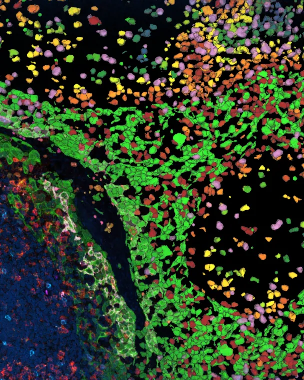 3D human tonsil tissue