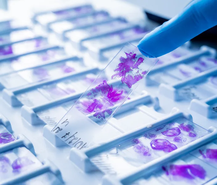 Hand in blue glove holding glass histology slides