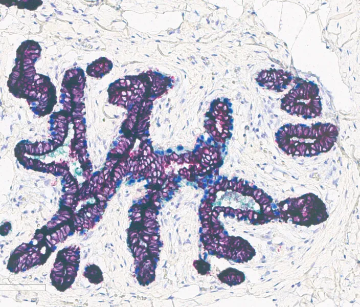 Multi-plex stain image from Leica Bio