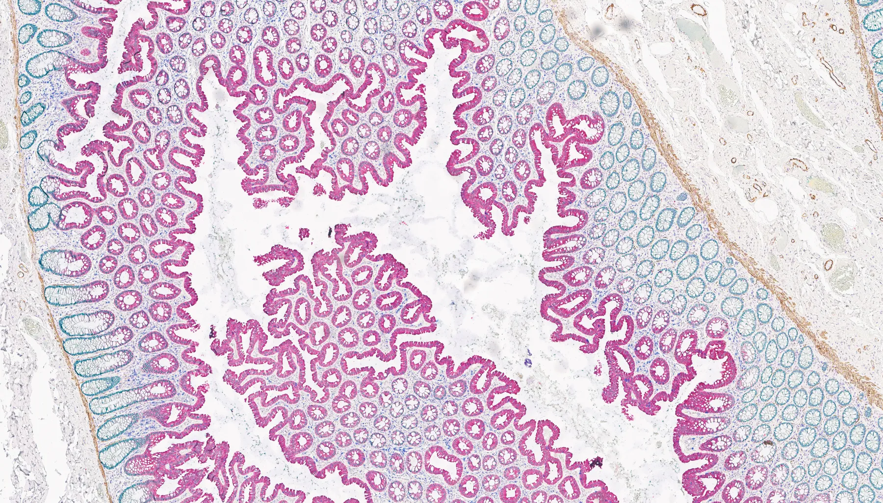 Colon tissue stained using the BOND RX and imaged with an Aperio digital pathology scanner.