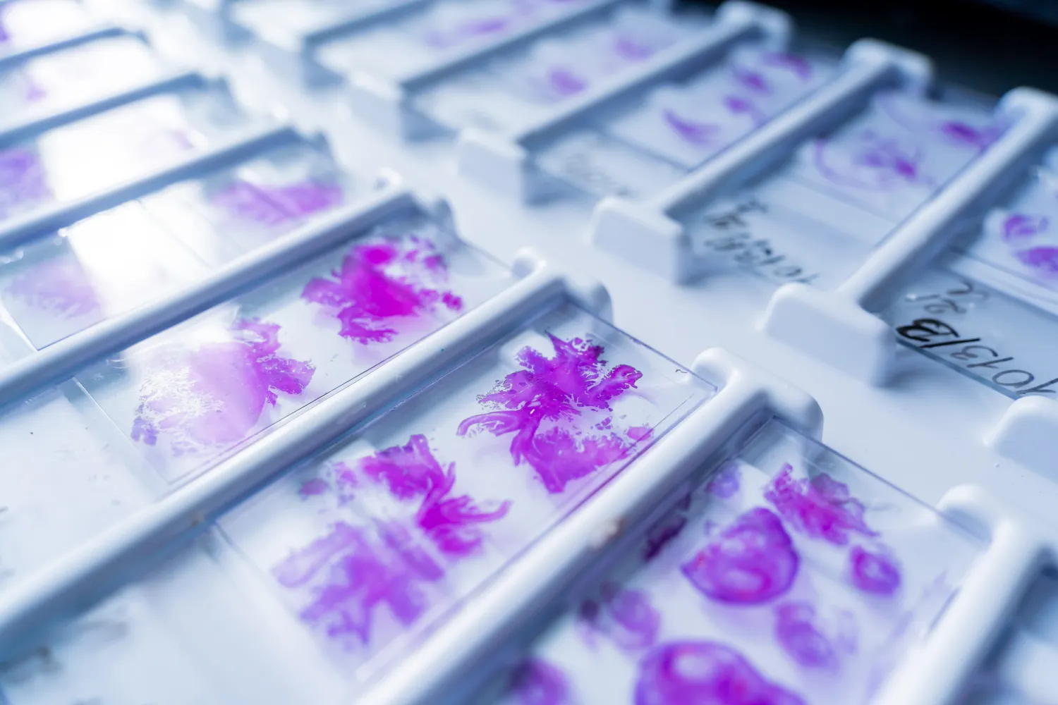 Close up of slides