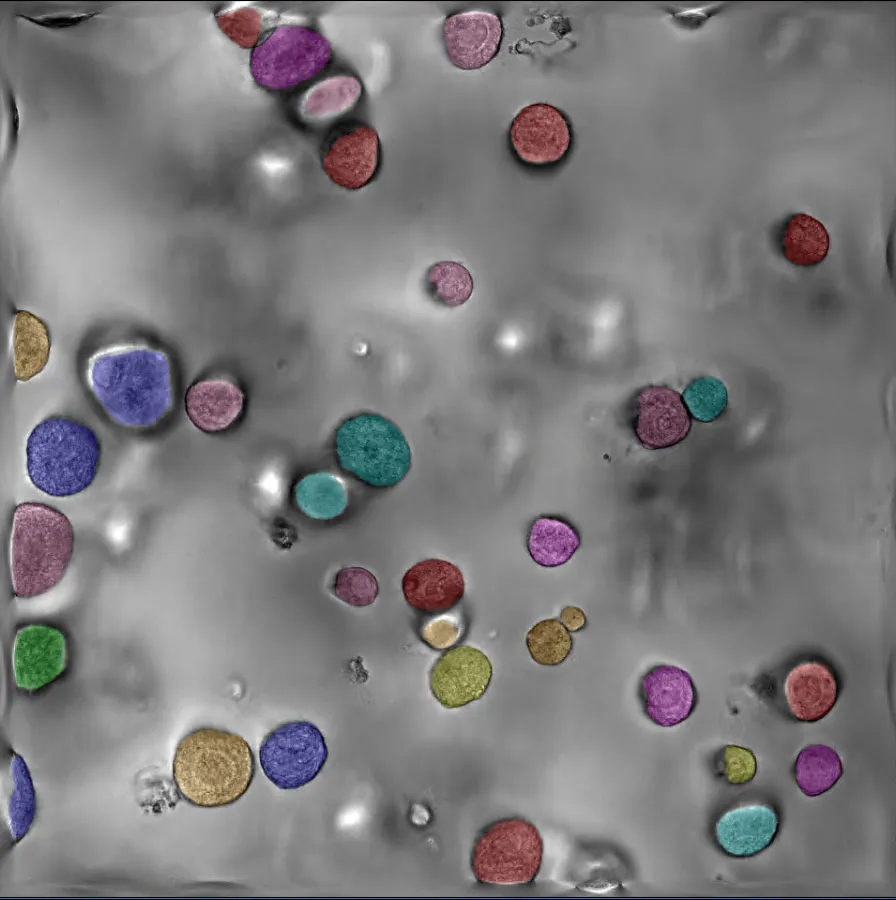 iPSC lung-derived organoid image