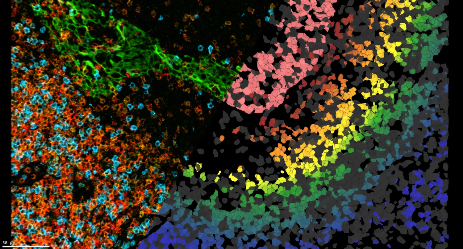 Split render of human tonsil tissue