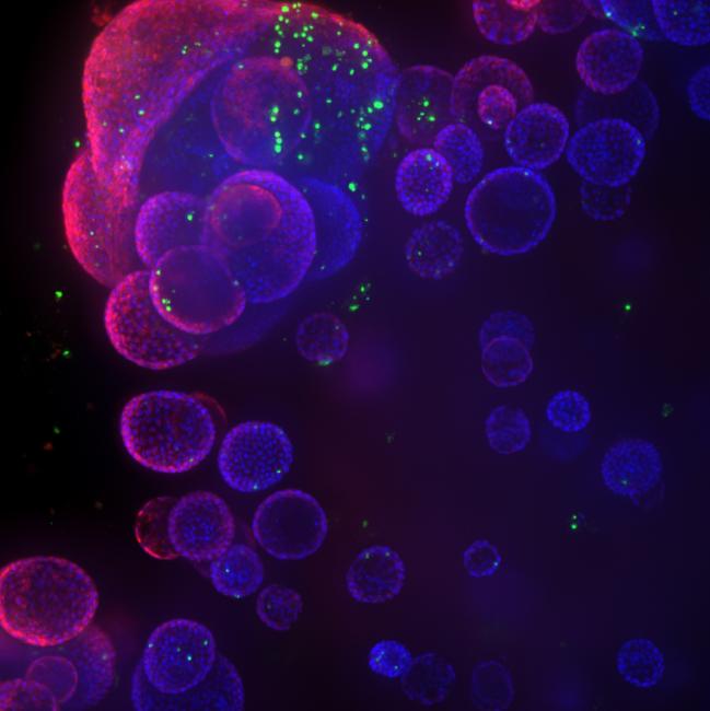Organoid